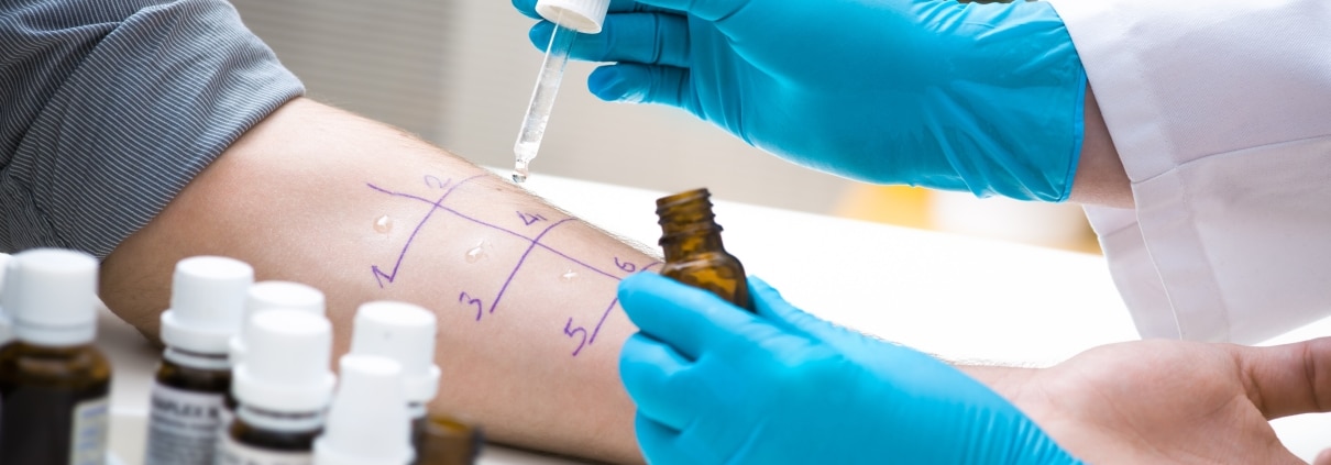 Medical professional performing an allergy test