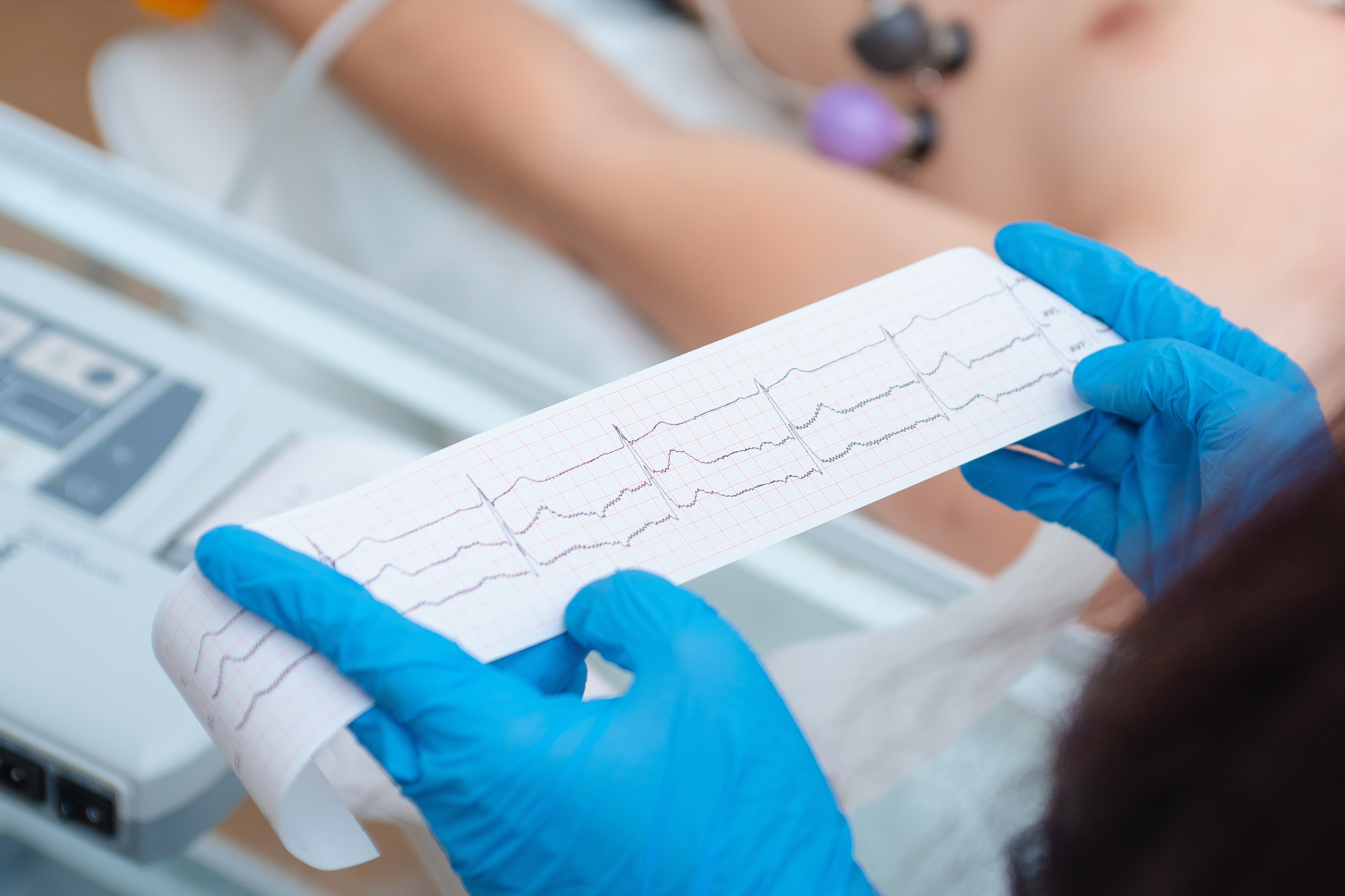 Gloved hands holding an electrocardiogram EKG reading